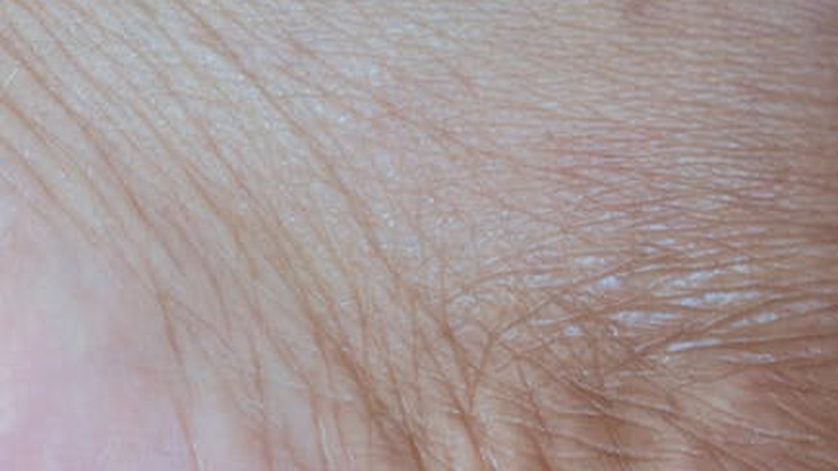 Dry Skin SOS: Hydration Hacks for the Transition to Colder Weather - Health and wellness